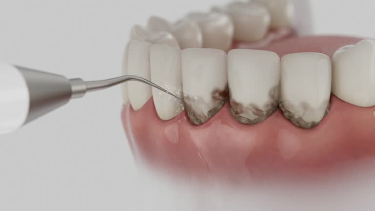 Trusted Emergency Dentist service in Pine Grove Mills, PA - Dentist Open Now